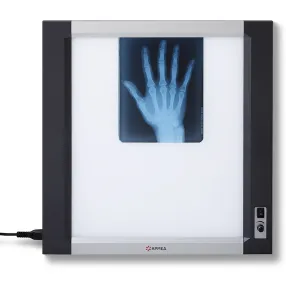 негатоскоп общего назначения 1-кадровый lux