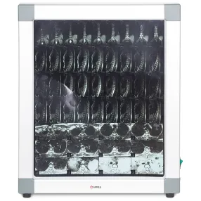 негатоскоп общего назначения 1-кадровый