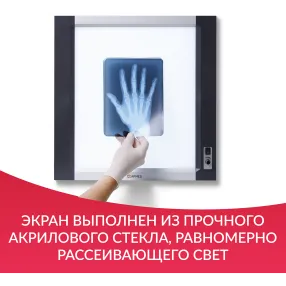 негатоскоп общего назначения 1-кадровый lux